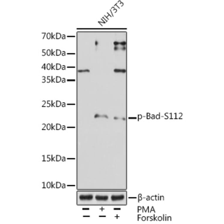 Western Blot - Anti-Bad (phospho Ser112) Antibody [ARC1555] (A309287) - Antibodies.com