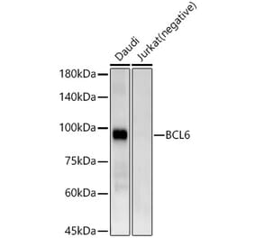 Western Blot - Anti-Bcl6 Antibody [ARC57886] (A309290) - Antibodies.com