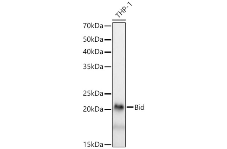 Western Blot - Anti-Bid Antibody [ARC59702] (A309291) - Antibodies.com