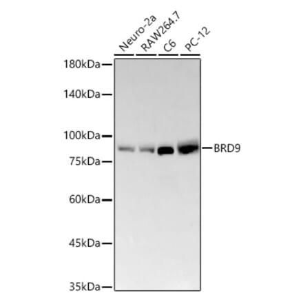 Western Blot - Anti-BRD9 Antibody [ARC58081] (A309293) - Antibodies.com