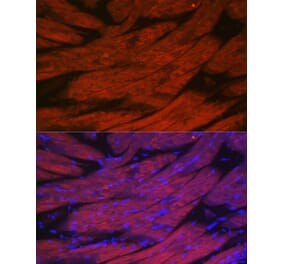 Immunofluorescence - Anti-CACNA1S Antibody (A309295) - Antibodies.com