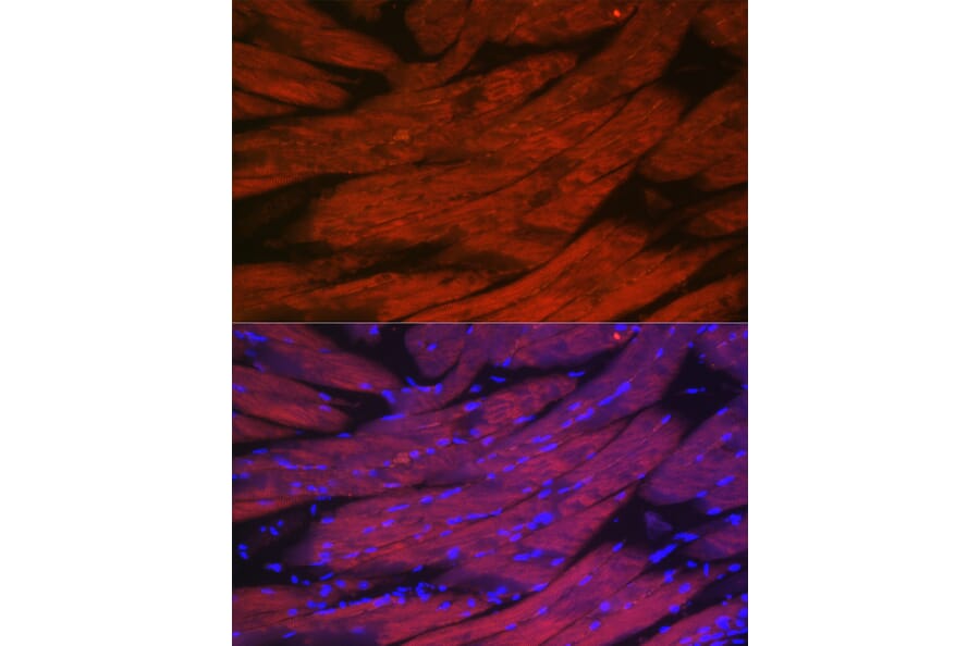 Immunofluorescence - Anti-CACNA1S Antibody (A309295) - Antibodies.com