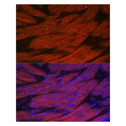 Immunofluorescence - Anti-CACNA1S Antibody (A309295) - Antibodies.com