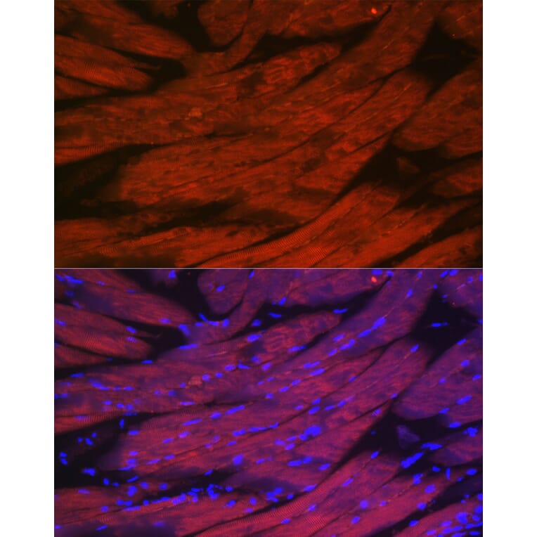Immunofluorescence - Anti-CACNA1S Antibody (A309295) - Antibodies.com