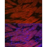 Immunofluorescence - Anti-CACNA1S Antibody (A309295) - Antibodies.com