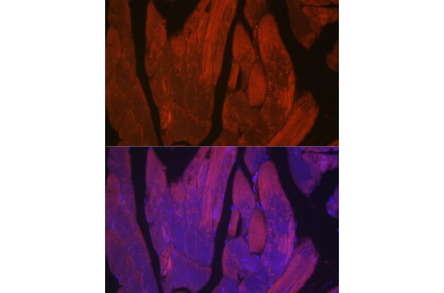 Immunofluorescence - Anti-CACNA1S Antibody (A309295) - Antibodies.com