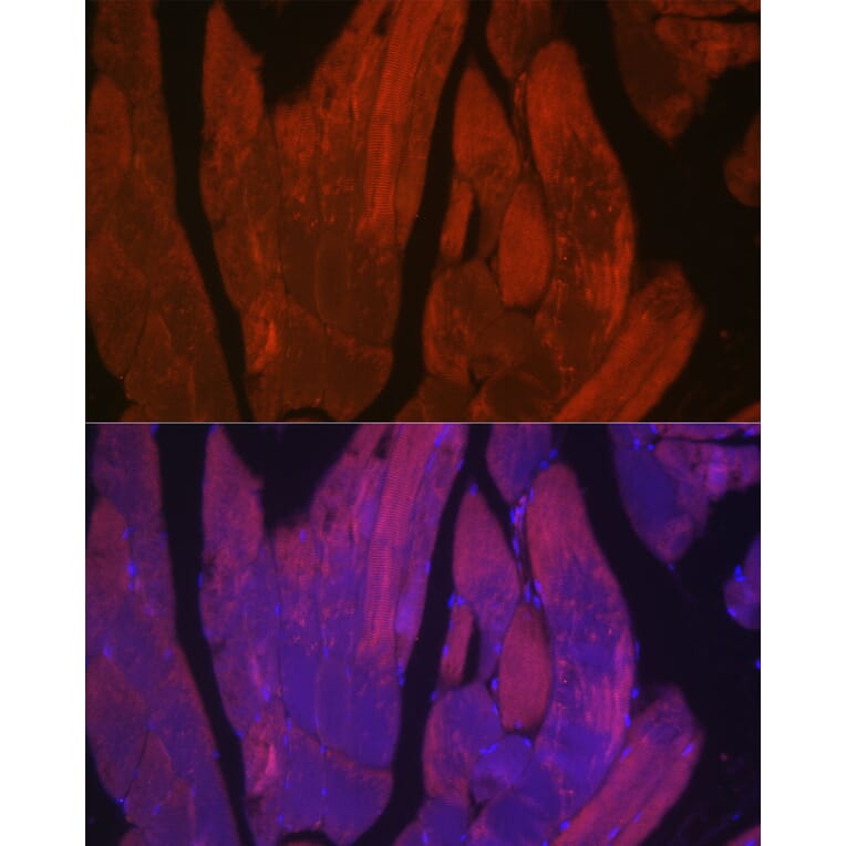 Immunofluorescence - Anti-CACNA1S Antibody (A309295) - Antibodies.com