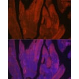 Immunofluorescence - Anti-CACNA1S Antibody (A309295) - Antibodies.com