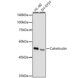 Western Blot - Anti-Calreticulin Antibody (A309296) - Antibodies.com