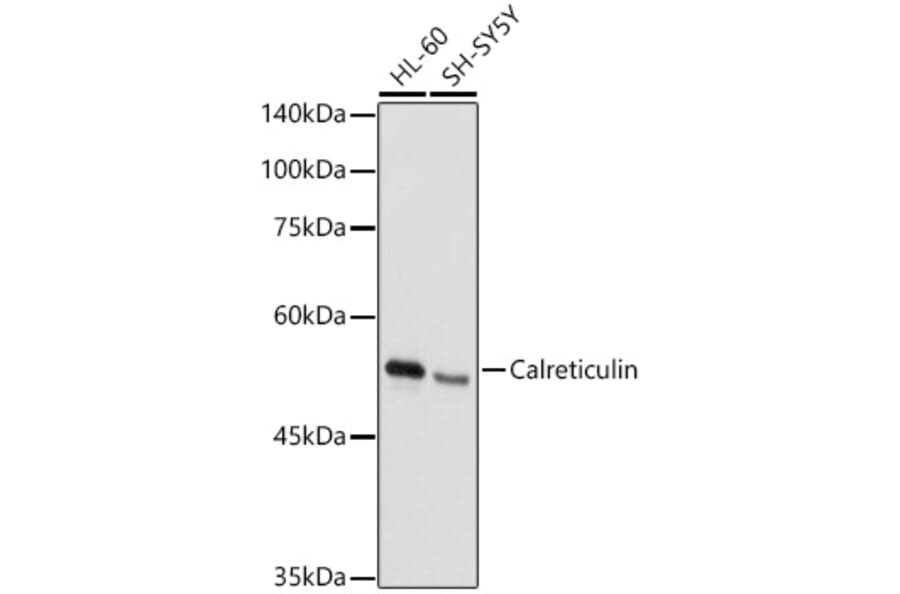 Western Blot - Anti-Calreticulin Antibody (A309296) - Antibodies.com