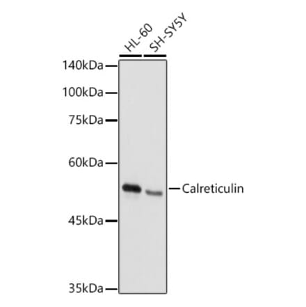 Western Blot - Anti-Calreticulin Antibody (A309296) - Antibodies.com