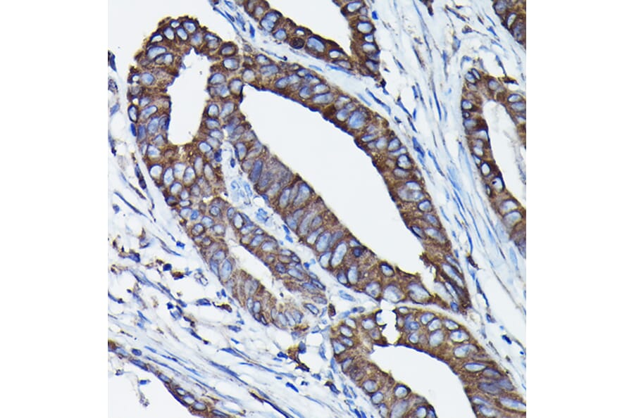 Immunohistochemistry - Anti-Calreticulin Antibody (A309296) - Antibodies.com