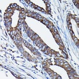 Immunohistochemistry - Anti-Calreticulin Antibody (A309296) - Antibodies.com