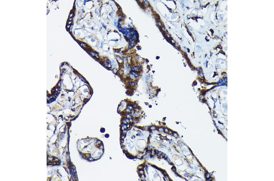 Immunohistochemistry - Anti-Calreticulin Antibody (A309296) - Antibodies.com