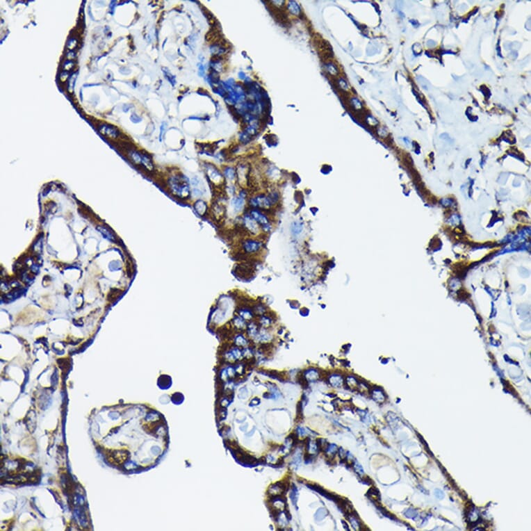 Immunohistochemistry - Anti-Calreticulin Antibody (A309296) - Antibodies.com