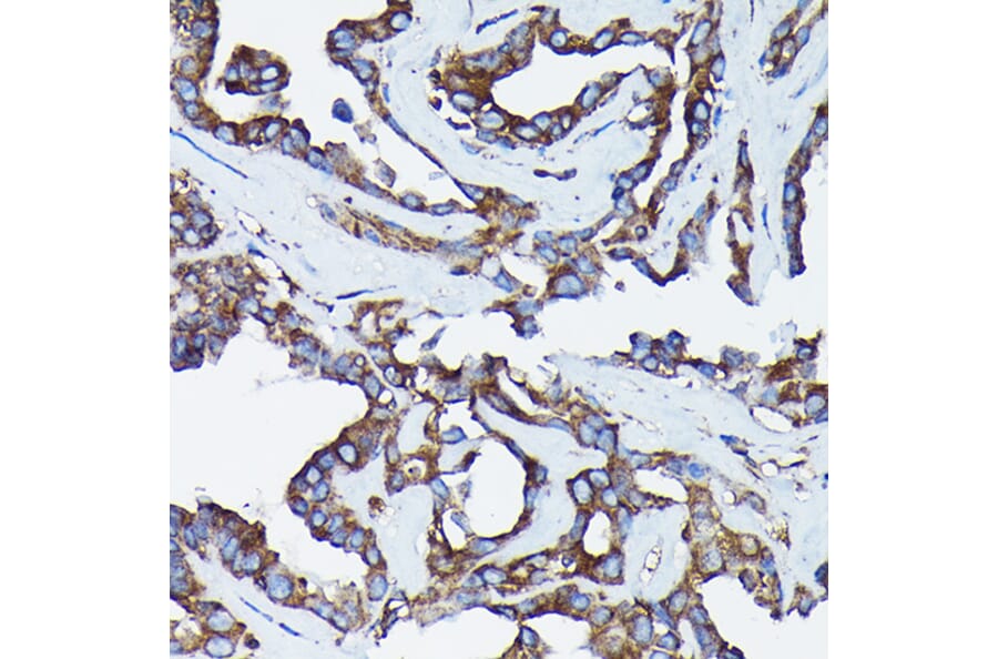 Immunohistochemistry - Anti-Calreticulin Antibody (A309296) - Antibodies.com