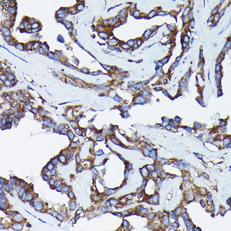 Immunohistochemistry - Anti-Calreticulin Antibody (A309296) - Antibodies.com