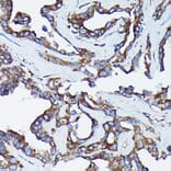 Immunohistochemistry - Anti-Calreticulin Antibody (A309296) - Antibodies.com