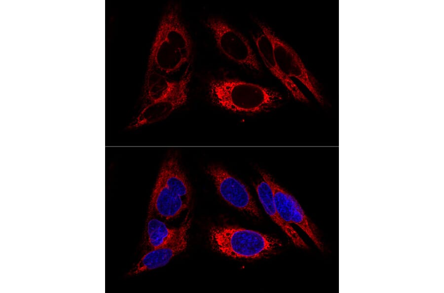 Immunofluorescence - Anti-Calreticulin Antibody (A309296) - Antibodies.com