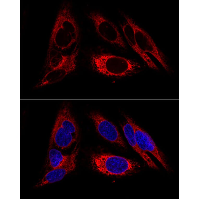 Immunofluorescence - Anti-Calreticulin Antibody (A309296) - Antibodies.com