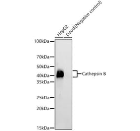 Western Blot - Anti-Cathepsin B Antibody [ARC59069] (A309298) - Antibodies.com