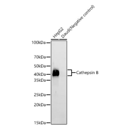 Western Blot - Anti-Cathepsin B Antibody [ARC59069] (A309298) - Antibodies.com