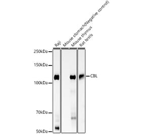 Western Blot - Anti-CBL Antibody [ARC59894] (A309299) - Antibodies.com