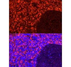Immunofluorescence - Anti-CD163 Antibody (A309302) - Antibodies.com