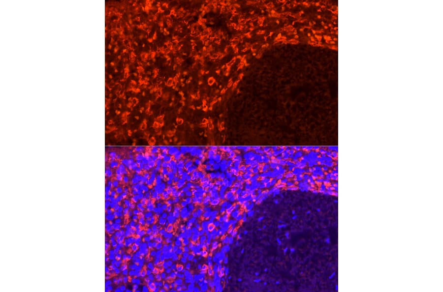 Immunofluorescence - Anti-CD163 Antibody [ARC58325] (A309302) - Antibodies.com