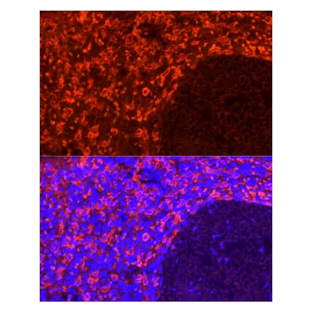 Immunofluorescence - Anti-CD163 Antibody [ARC58325] (A309302) - Antibodies.com