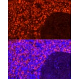 Immunofluorescence - Anti-CD163 Antibody [ARC58325] (A309302) - Antibodies.com