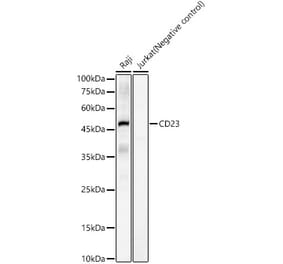 Western Blot - Anti-CD23 Antibody (A309306) - Antibodies.com