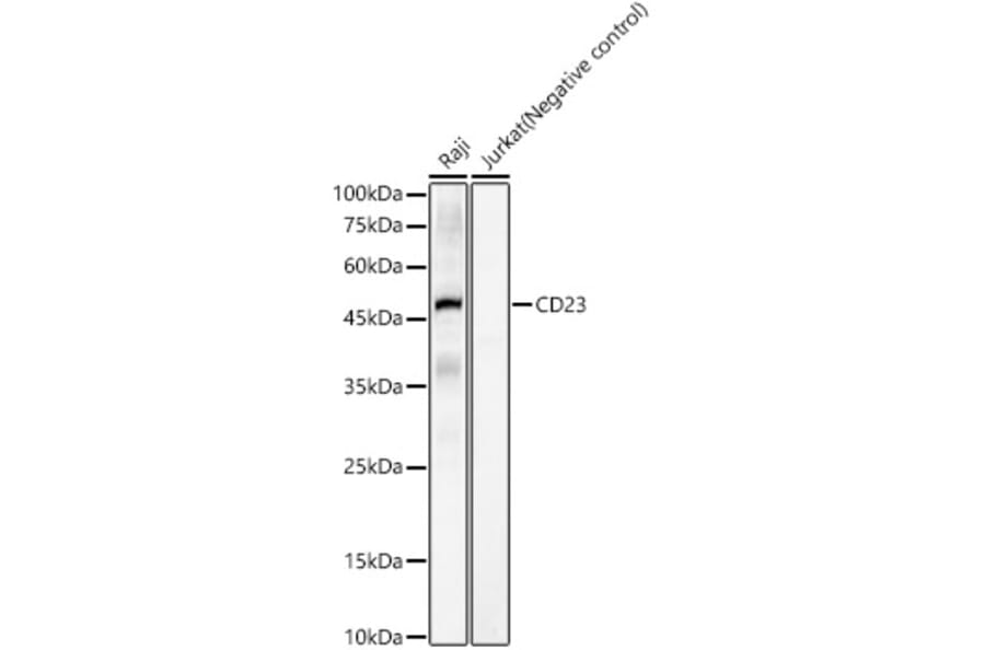 Western Blot - Anti-CD23 Antibody [ARC55626] (A309306) - Antibodies.com