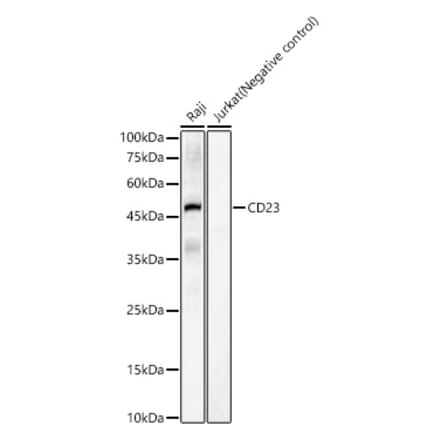 Western Blot - Anti-CD23 Antibody [ARC55626] (A309306) - Antibodies.com