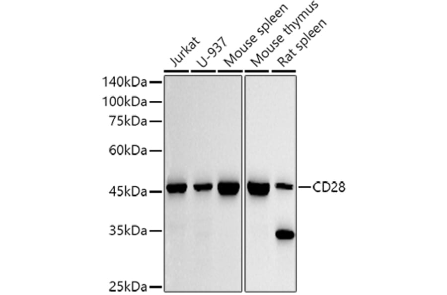 Western Blot - Anti-CD28 Antibody (A309309) - Antibodies.com