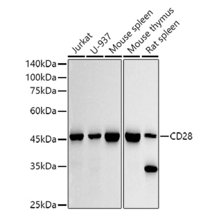 Western Blot - Anti-CD28 Antibody [ARC5082-01] (A309309) - Antibodies.com