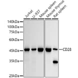 Western Blot - Anti-CD28 Antibody (A309309) - Antibodies.com