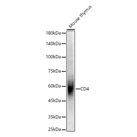 Western Blot - Anti-CD4 Antibody (A309315) - Antibodies.com