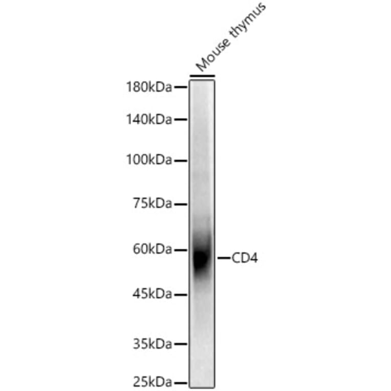 Western Blot - Anti-CD4 Antibody (A309315) - Antibodies.com