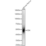 Western Blot - Anti-CD4 Antibody (A309315) - Antibodies.com