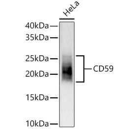 Western Blot - Anti-CD59 Antibody (A309320) - Antibodies.com