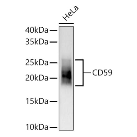 Western Blot - Anti-CD59 Antibody [ARC56723] (A309320) - Antibodies.com