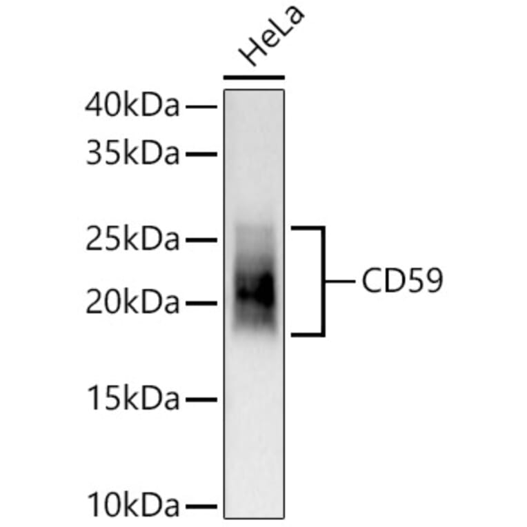 Western Blot - Anti-CD59 Antibody [ARC56723] (A309320) - Antibodies.com