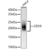 Western Blot - Anti-CD59 Antibody [ARC56723] (A309320) - Antibodies.com