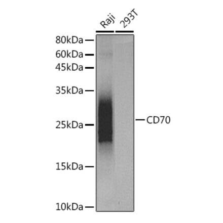 Western Blot - Anti-CD70 Antibody [ARC5081-01] (A309324) - Antibodies.com