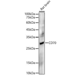 Western Blot - Anti-CD70 Antibody [ARC5081-02] (A309325) - Antibodies.com