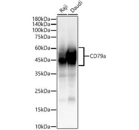 Western Blot - Anti-CD79a Antibody [ARC51145 + ARC51147] (A309326) - Antibodies.com