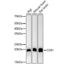Western Blot - Anti-CD81 Antibody [ARC57928 + ARC57931] (A309327) - Antibodies.com
