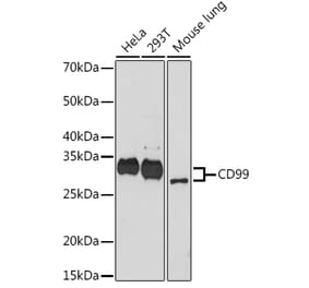 Western Blot - Anti-CD99 Antibody (A309328) - Antibodies.com