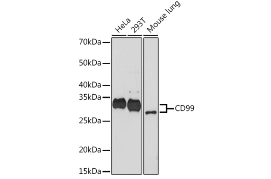 Western Blot - Anti-CD99 Antibody [ARC1752] (A309328) - Antibodies.com